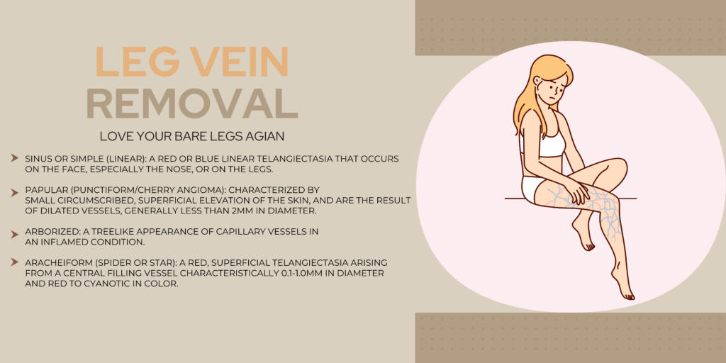 Leg Vein 1